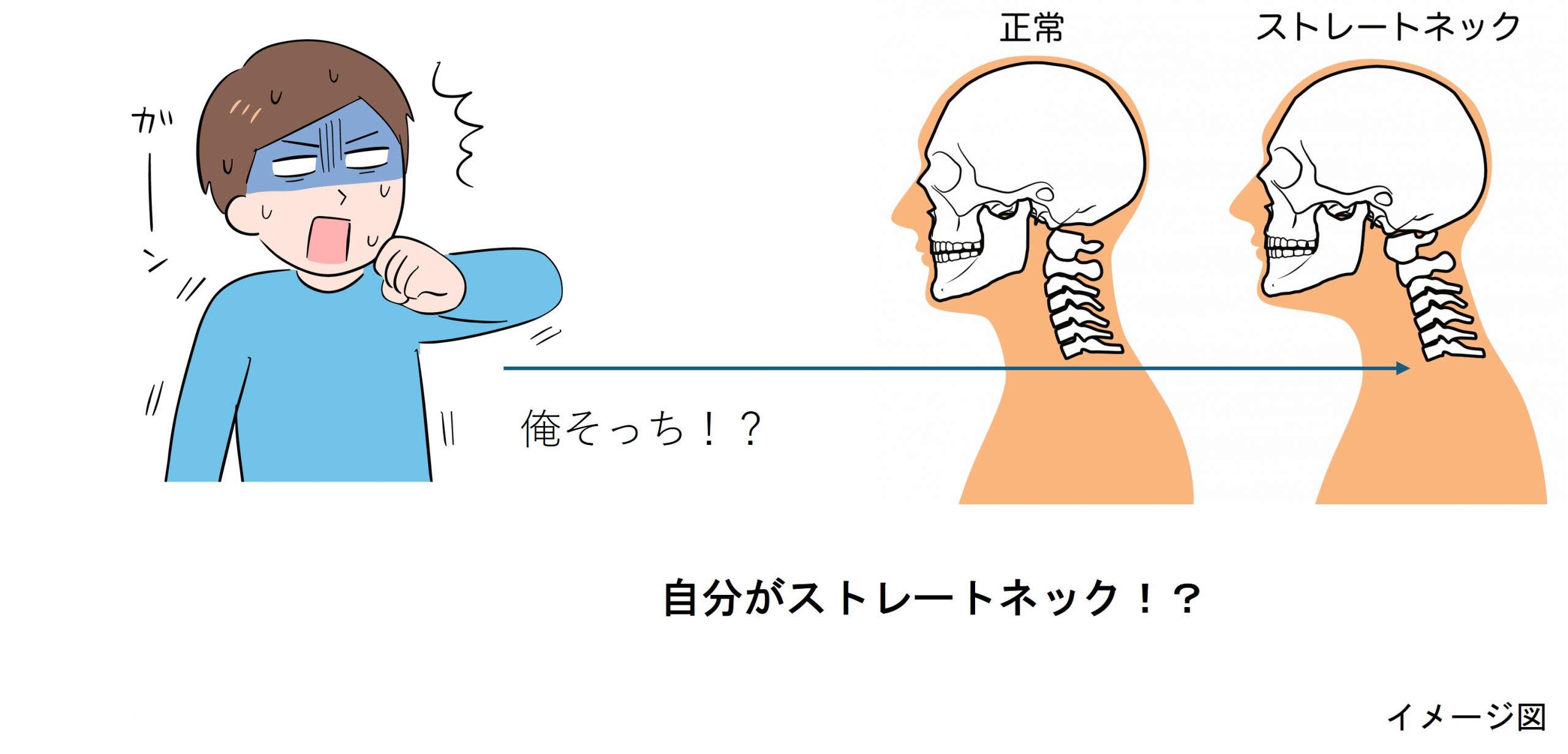 ストレート ネック チェック