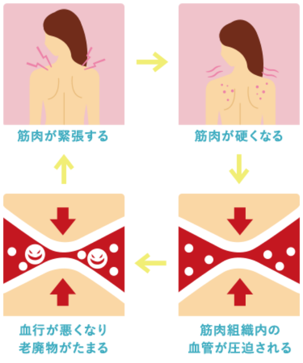筋肉が緊張する→筋肉が硬くなる→筋肉組織内の血管が圧迫される→血行が悪くなり老廃物がたまる