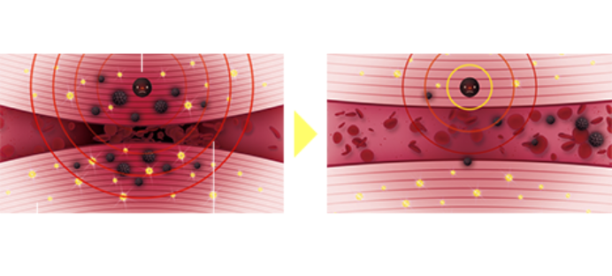 磁気によって、老廃物を流す